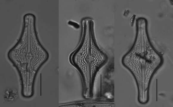 Imagem de Brachysira follis (Ehrenberg) R. Ross 1986