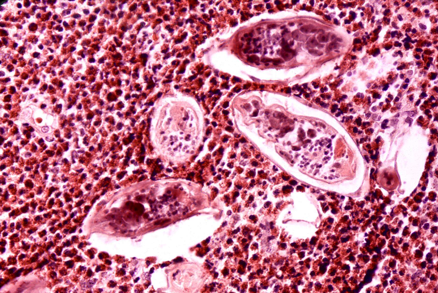 Image de Schistosoma haematobium
