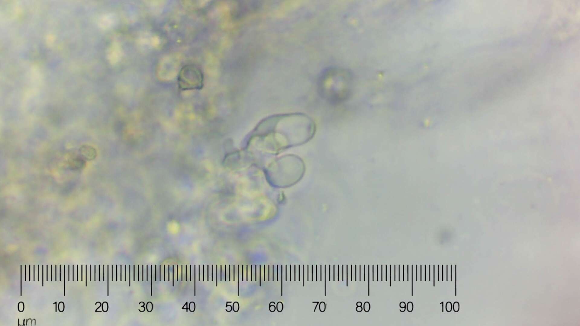 Image of Trechispora hymenocystis (Berk. & Broome) K. H. Larss. 1994