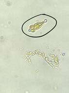 صورة Gomphonema acuminatum