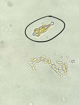 Слика од Gomphonema acuminatum