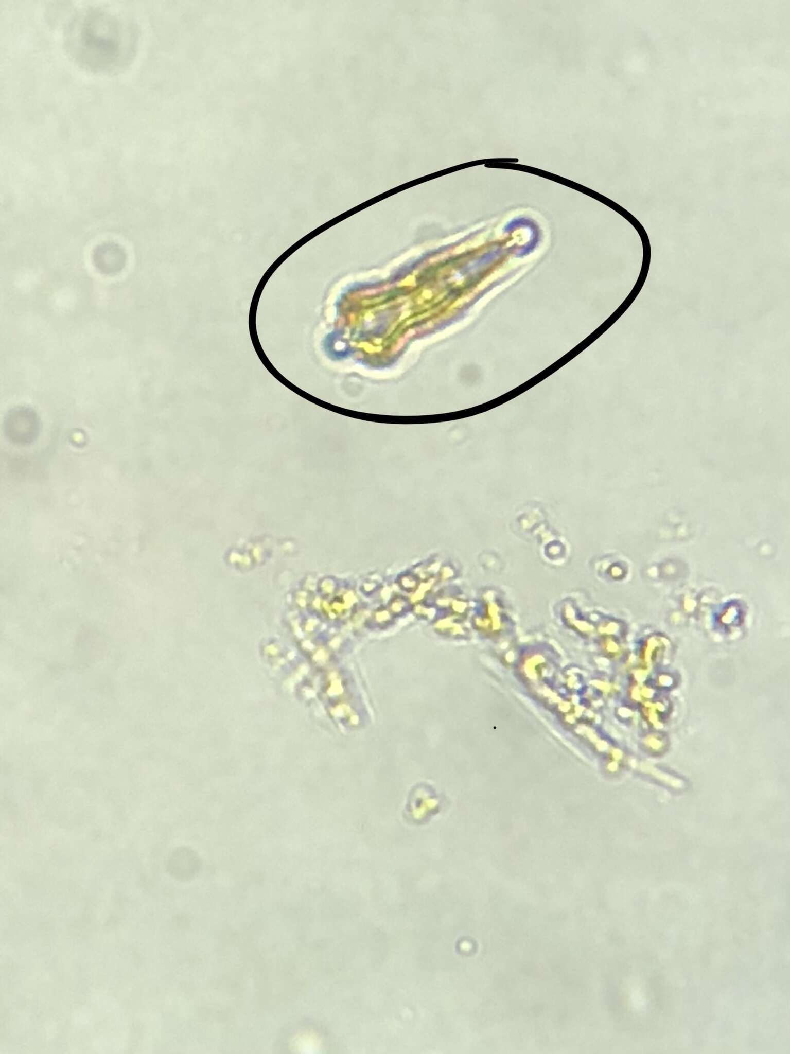 Imagem de Gomphonema acuminatum