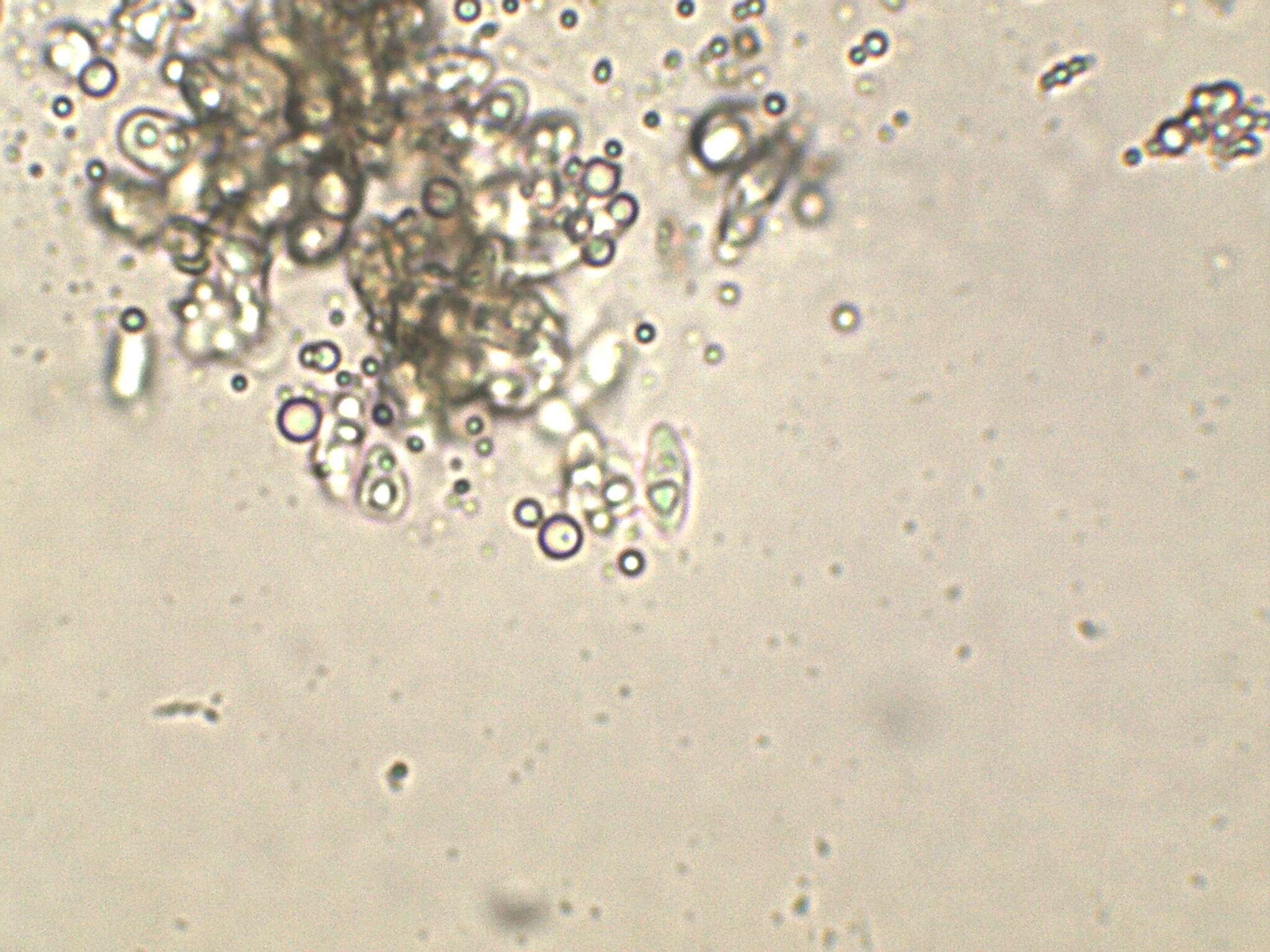 Sivun Ascodichaenaceae kuva