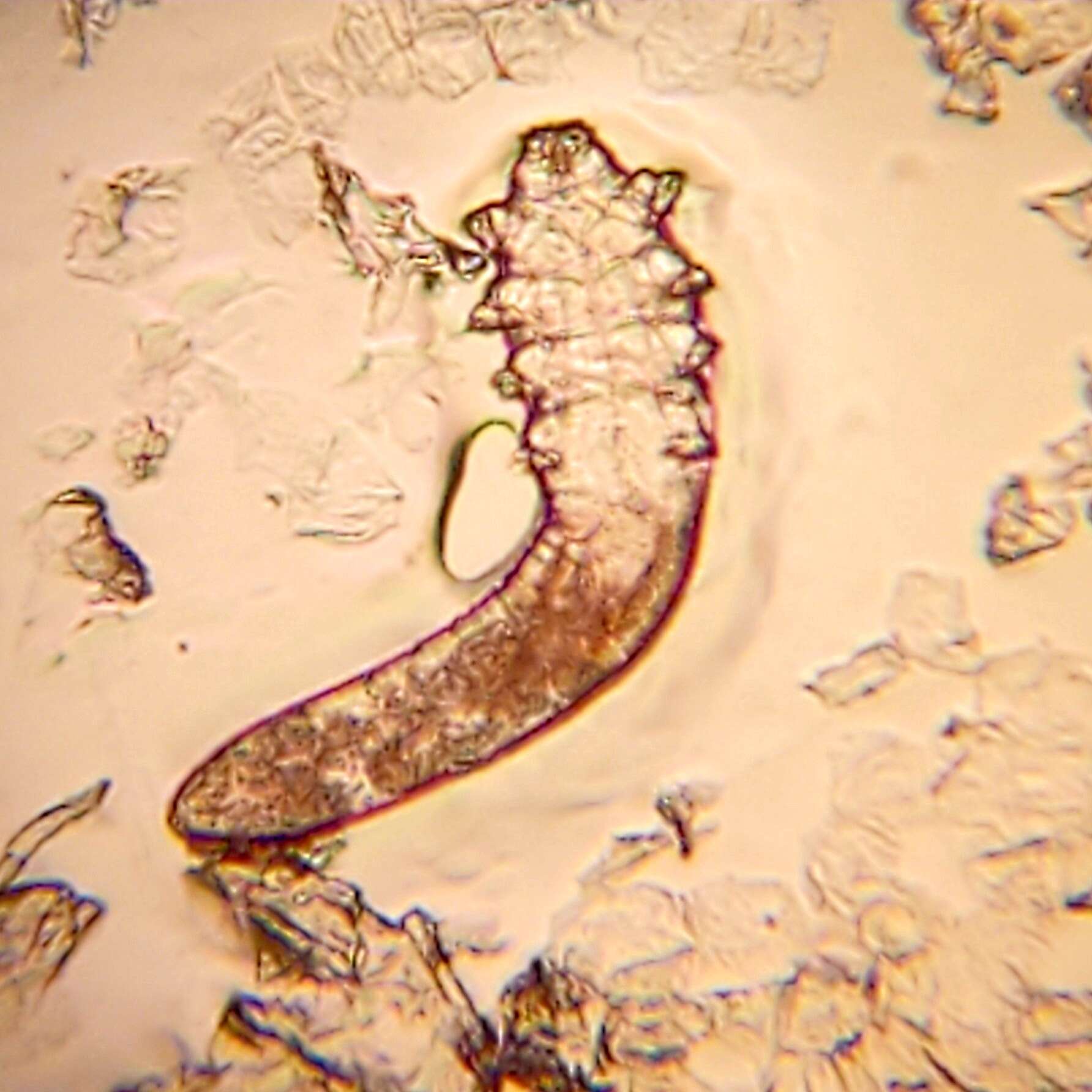 Imagem de Demodex folliculorum Simon 1842