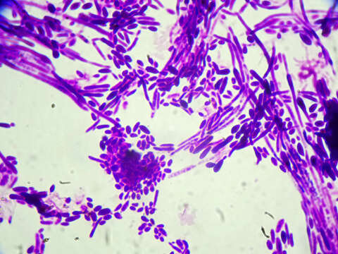 Image of Candida dubliniensis D. J. Sullivan, Western., K. A. Haynes, Dés. E. Benn. & D. C. Coleman 1995