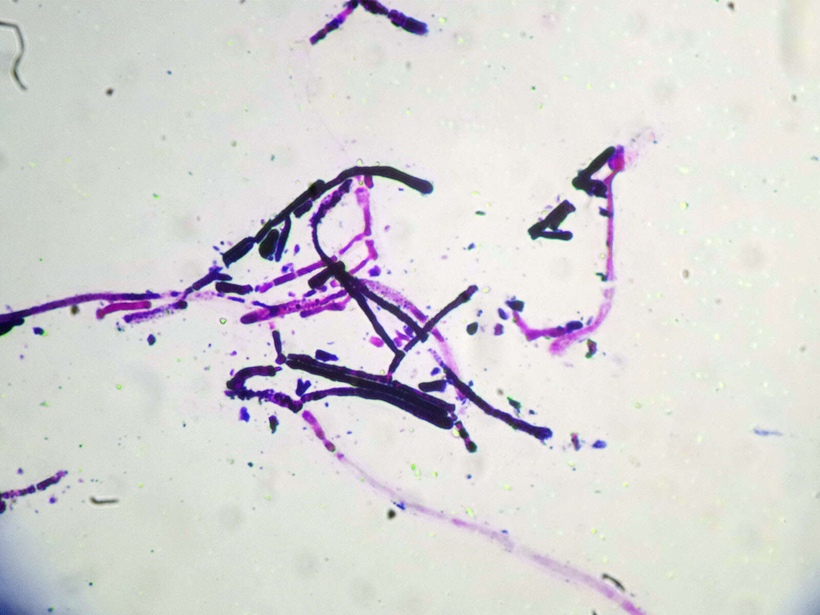 Imagem de Dipodascus geotrichum (E. E. Butler & L. J. Petersen) Arx 1977