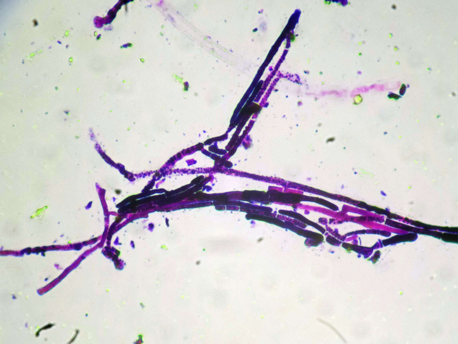 Dipodascus geotrichum (E. E. Butler & L. J. Petersen) Arx 1977 resmi