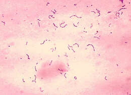 Image de Streptococcus mutans