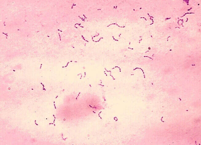 Image of Streptococcus mutans