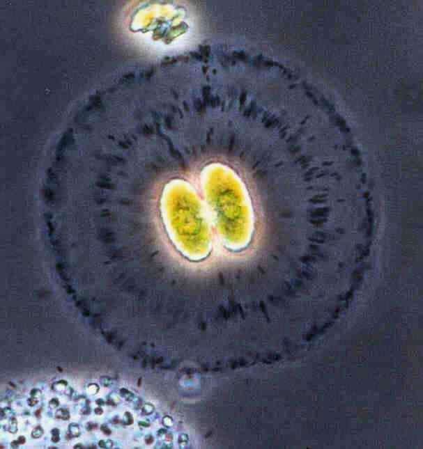 Image of cosmarian algae