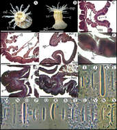 Image of Anthopleura Duchassaing de Fonbressin & Michelotti 1860