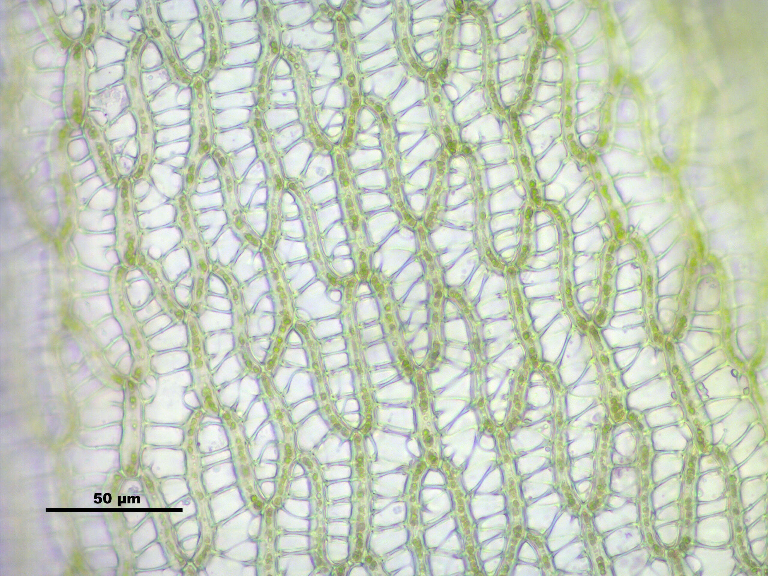 Image de Sphagnum angustifolium C. E. O. Jensen 1896