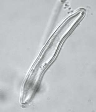 Image of <i>Eunotia pectinalis</i> var. <i>undulata</i> (Ralfs) Rabenh.