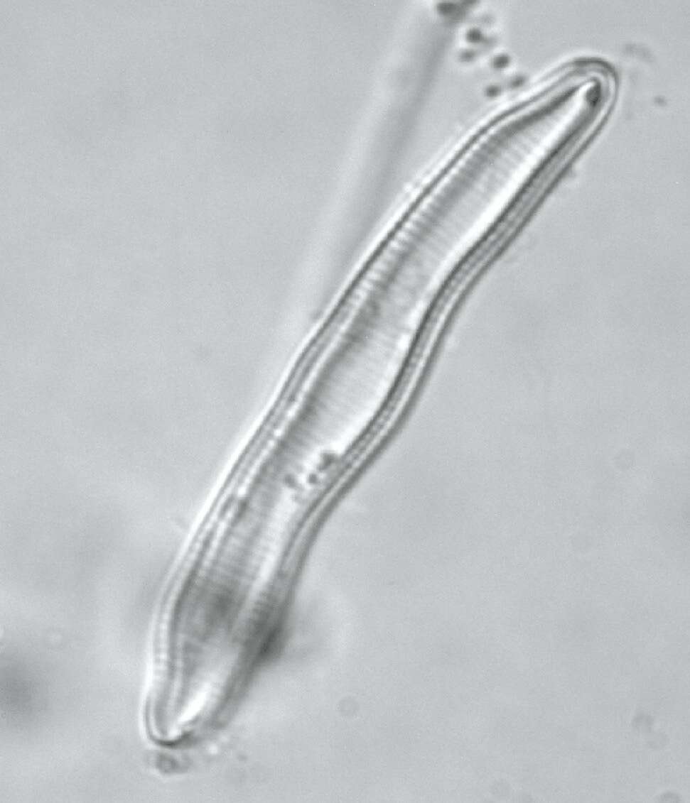 Imagem de <i>Eunotia pectinalis</i> var. <i>undulata</i> (Ralfs) Rabenh.