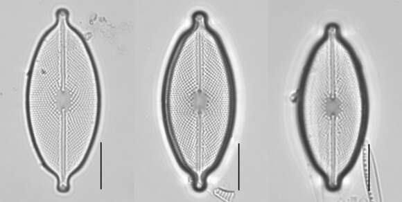 Image of Decussiphycus placenta (Ehrenberg) Guiry & Gandhi 2019