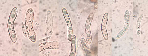 Echinosphaeria strigosa (Alb. & Schwein.) Declercq 2009 resmi