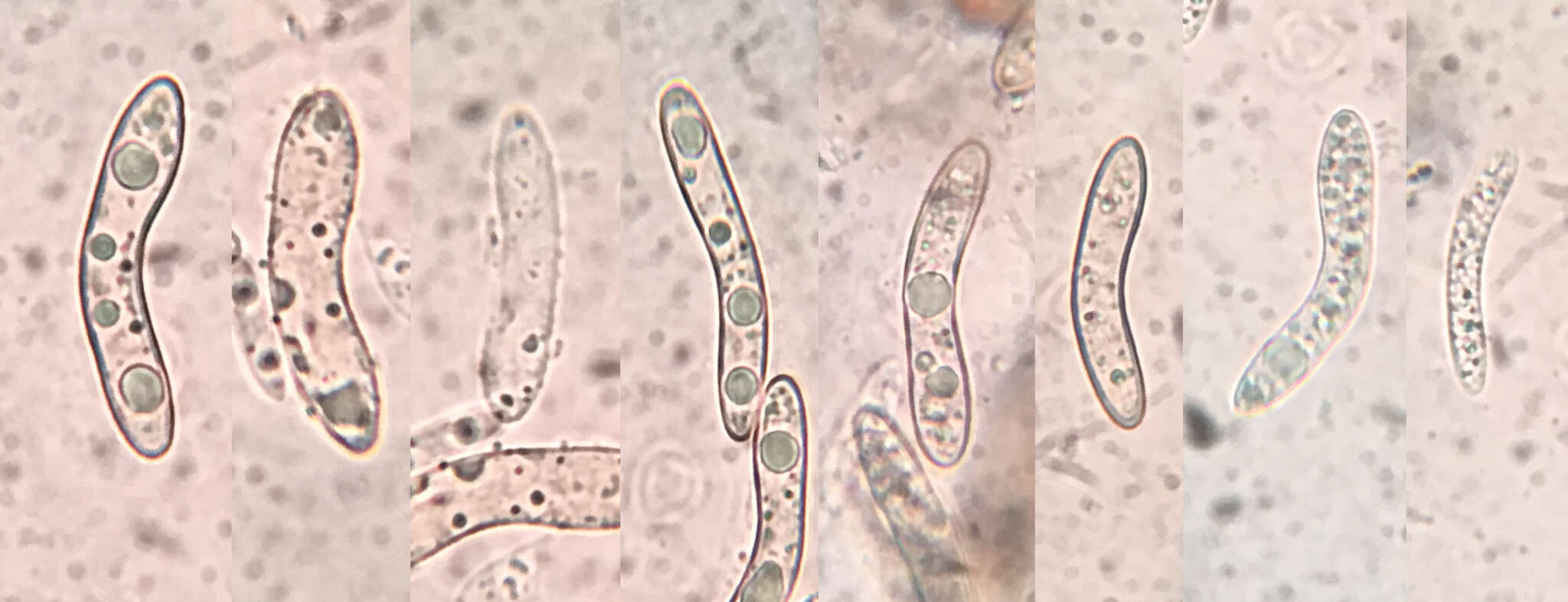 Echinosphaeria strigosa (Alb. & Schwein.) Declercq 2009的圖片