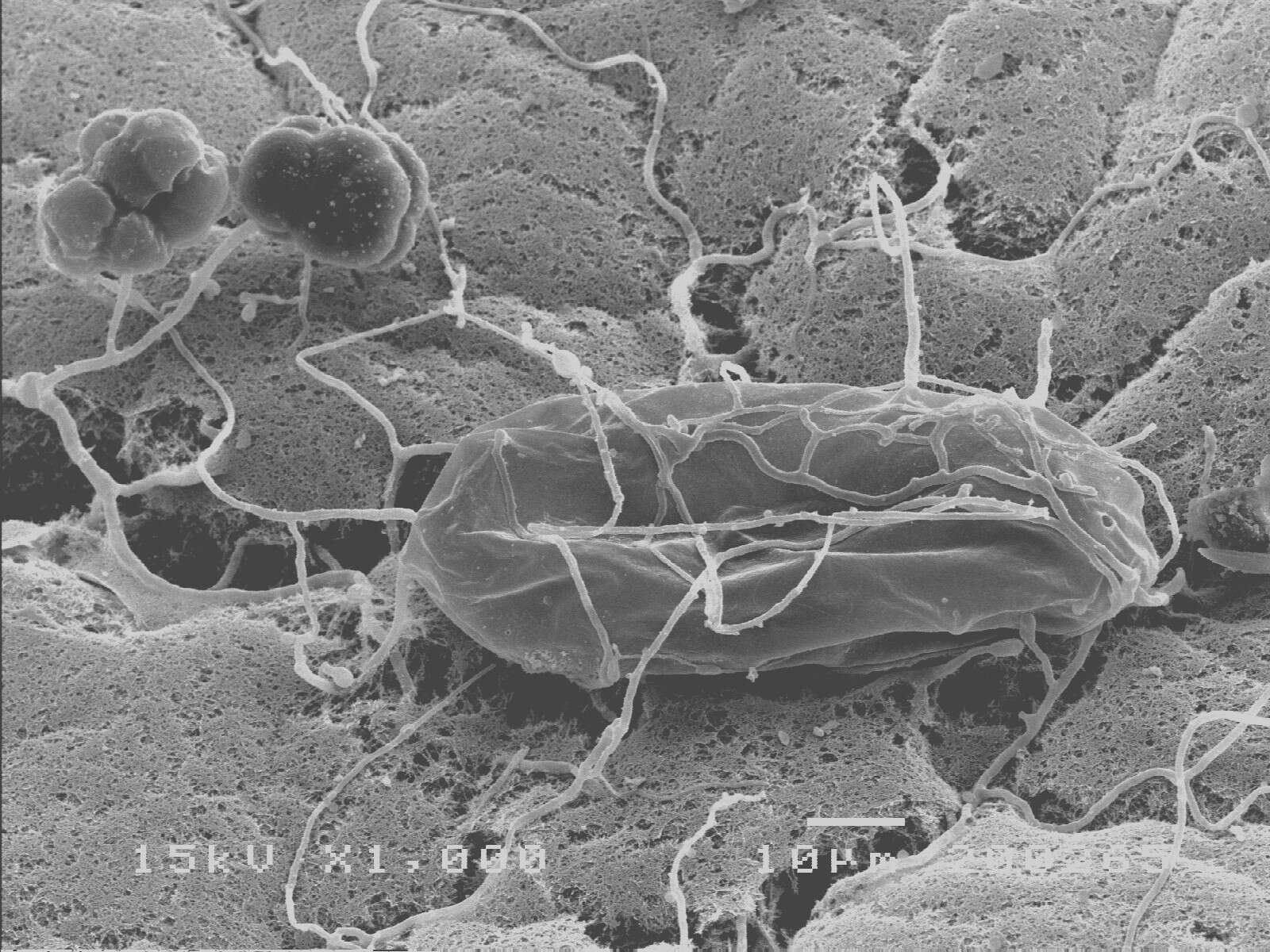 Image of Metacordyceps chlamydosporia (H. C. Evans) G. H. Sung, J. M. Sung, Hywel-Jones & Spatafora 2007