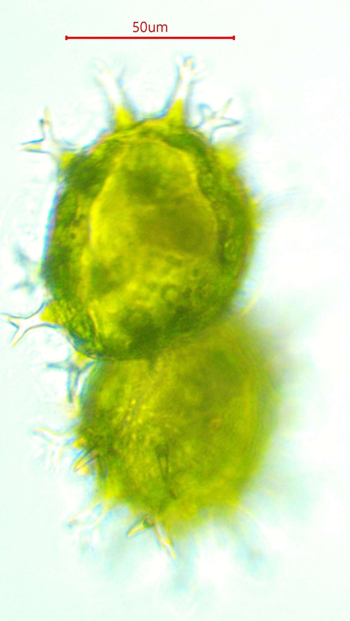 Image of Xanthidium armatum