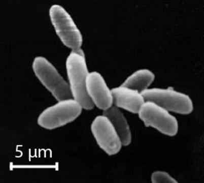 Слика од Halobacteria