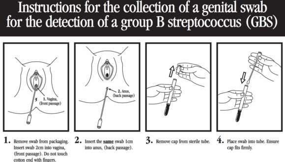 Plancia ëd Streptococcus agalactiae