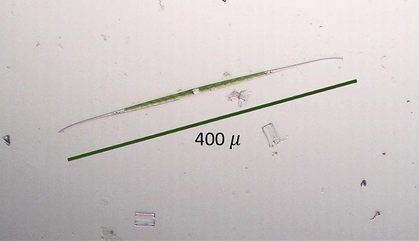 Image of Closterium aciculare T. West 1860