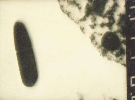 Image de Clostridium perfringens
