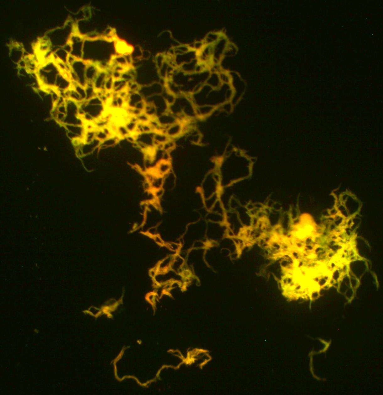 Image of 'Mycobacterium tuberculosis complex'