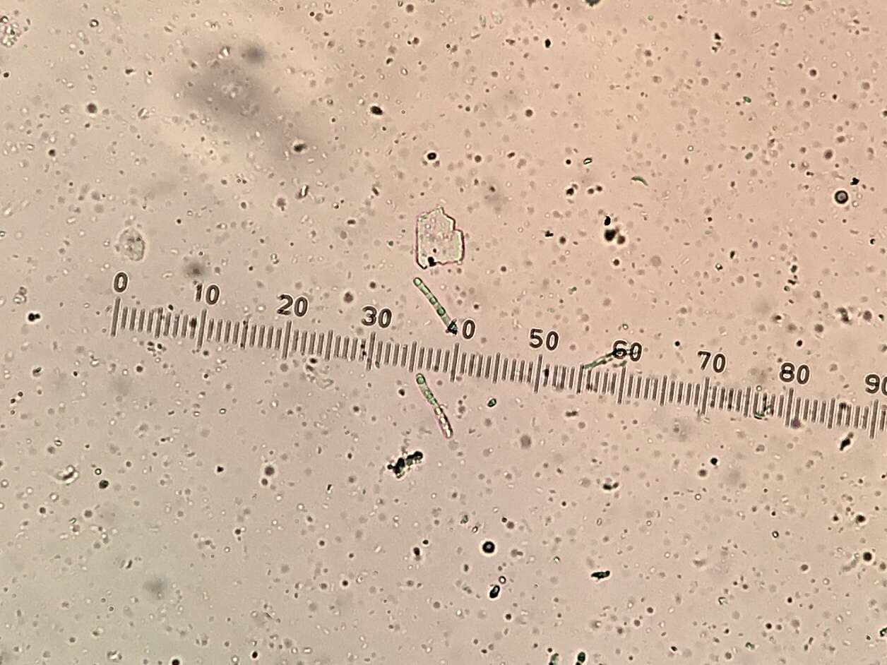 Image of Sarcopyrenia calcarea Lendemer & R. C. Harris 2013