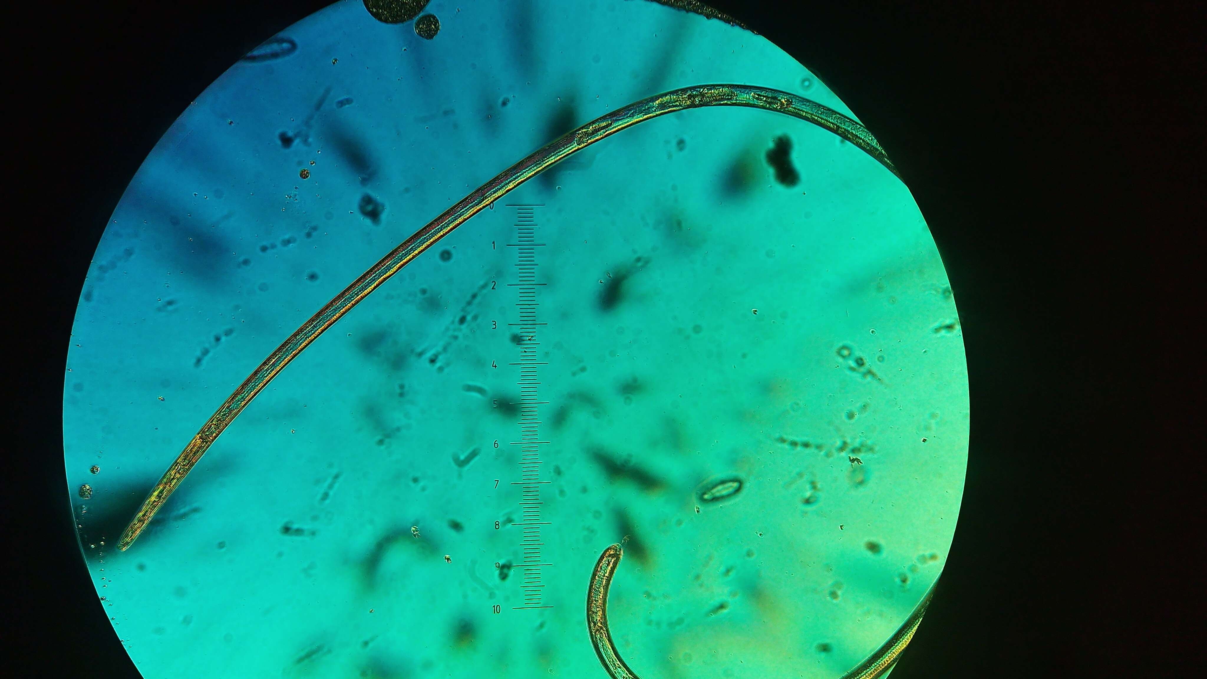 Image of nematodes