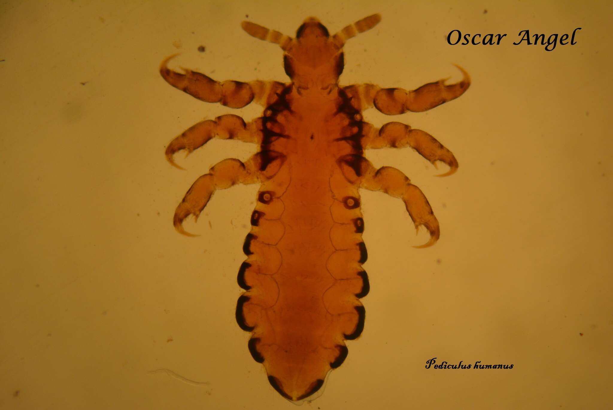 Image of sucking louse