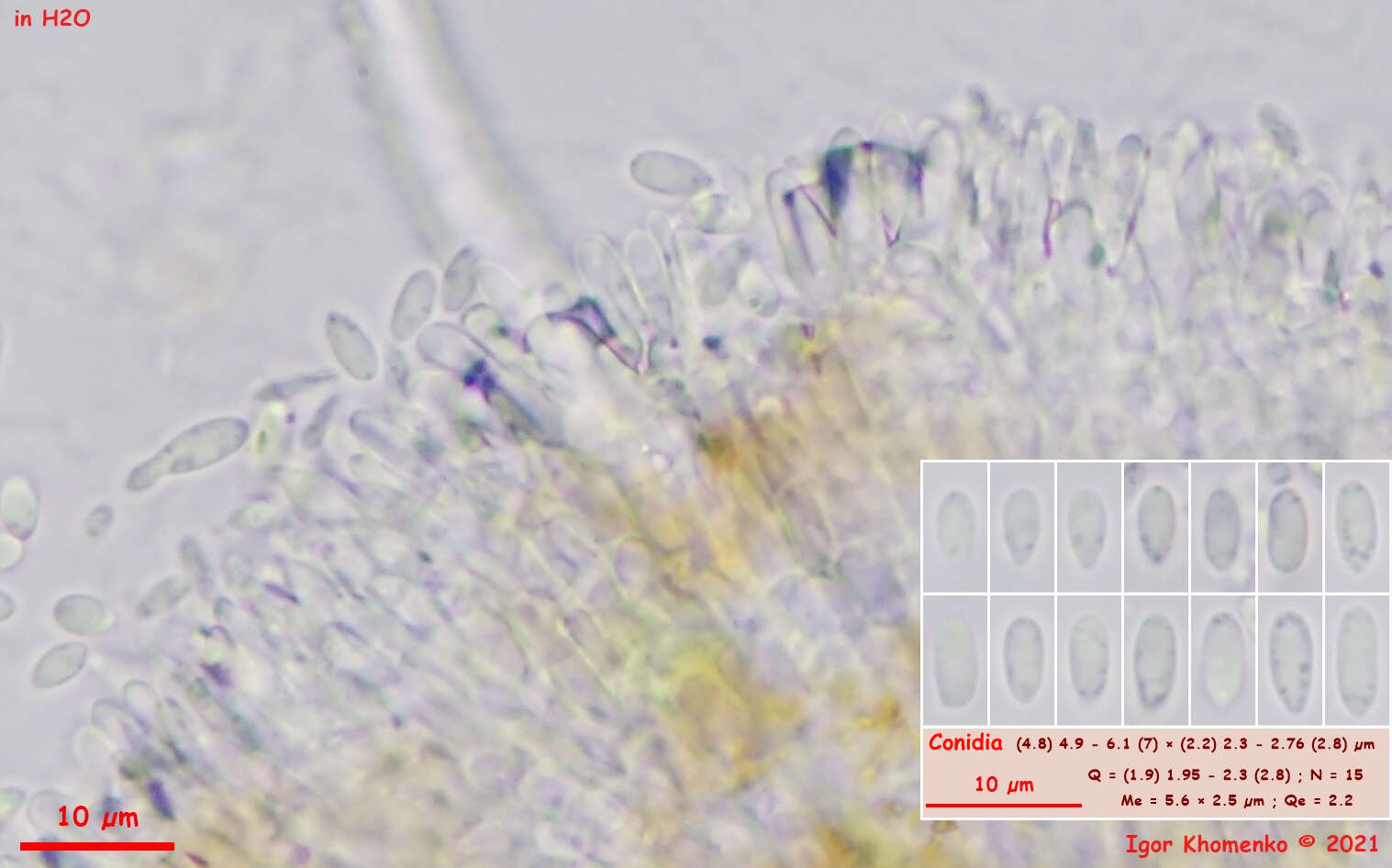 Volutella ciliata (Alb. & Schwein.) Fr. 1832 resmi