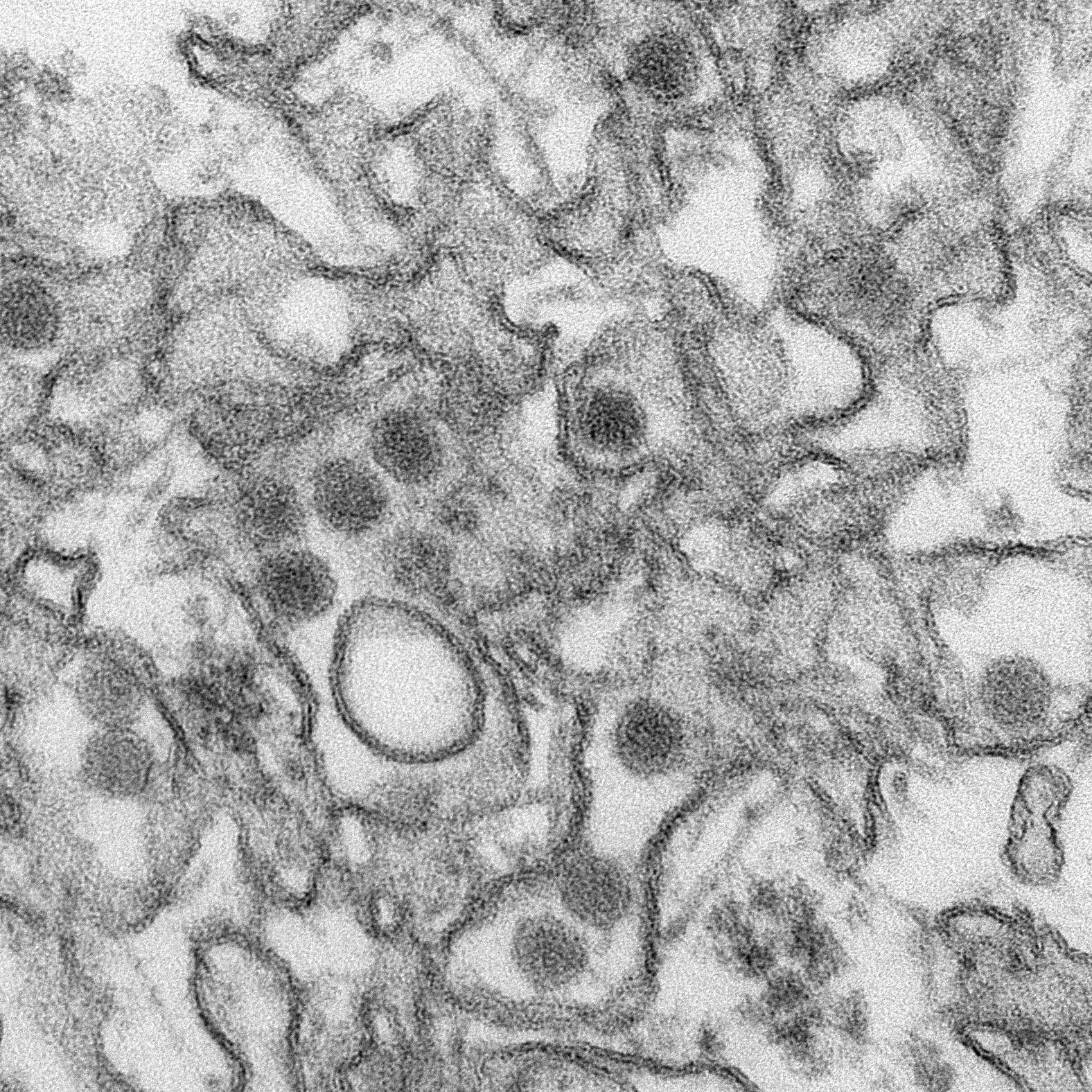 Image of Zika virus