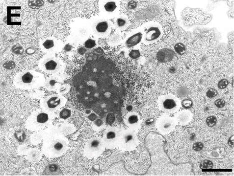 Plancia ëd Mimivirus-dependent virus Zamilon