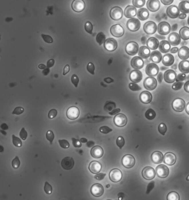 Image of gram-positive bacteria