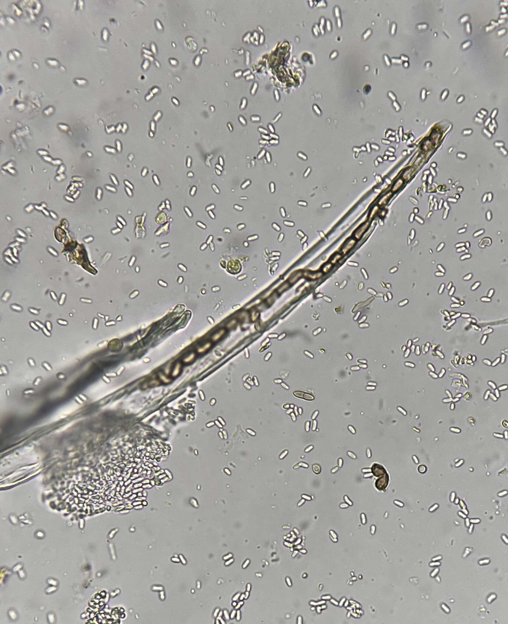 Image of Psiloglonium stygium (Berk. & M. A. Curtis) Rossman & W. C. Allen 2016