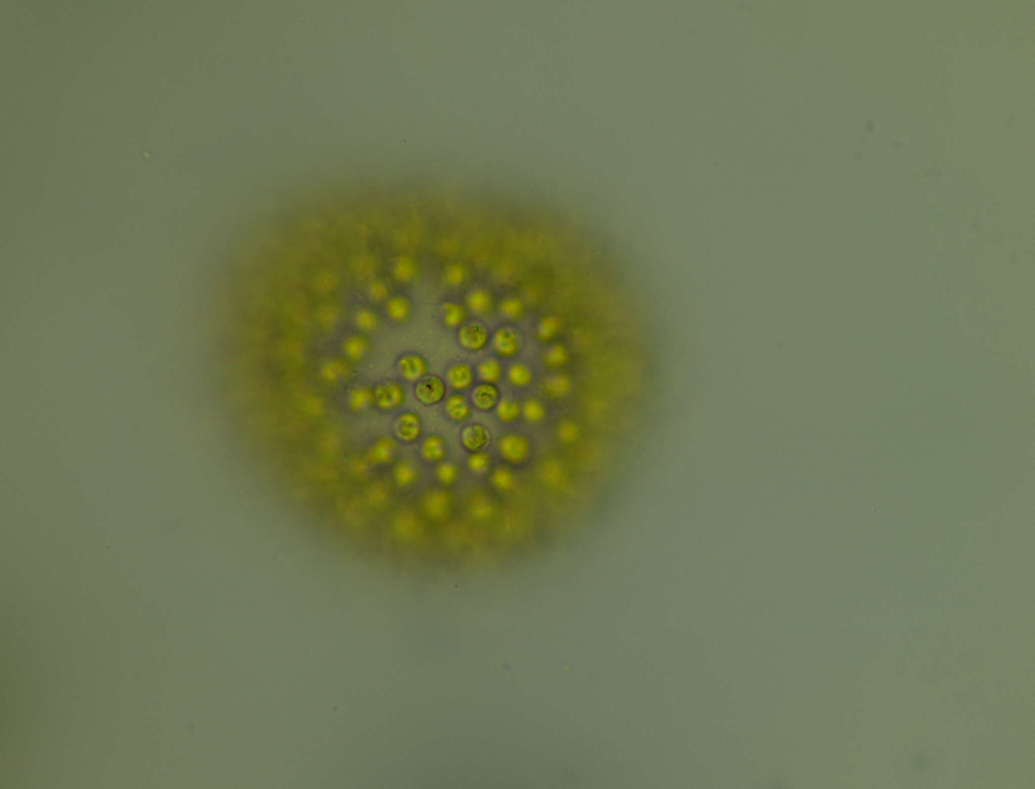 Image of Uroglena volvox