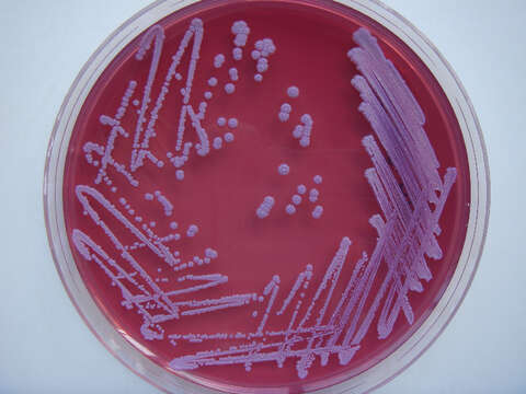 Image de Burkholderia pseudomallei