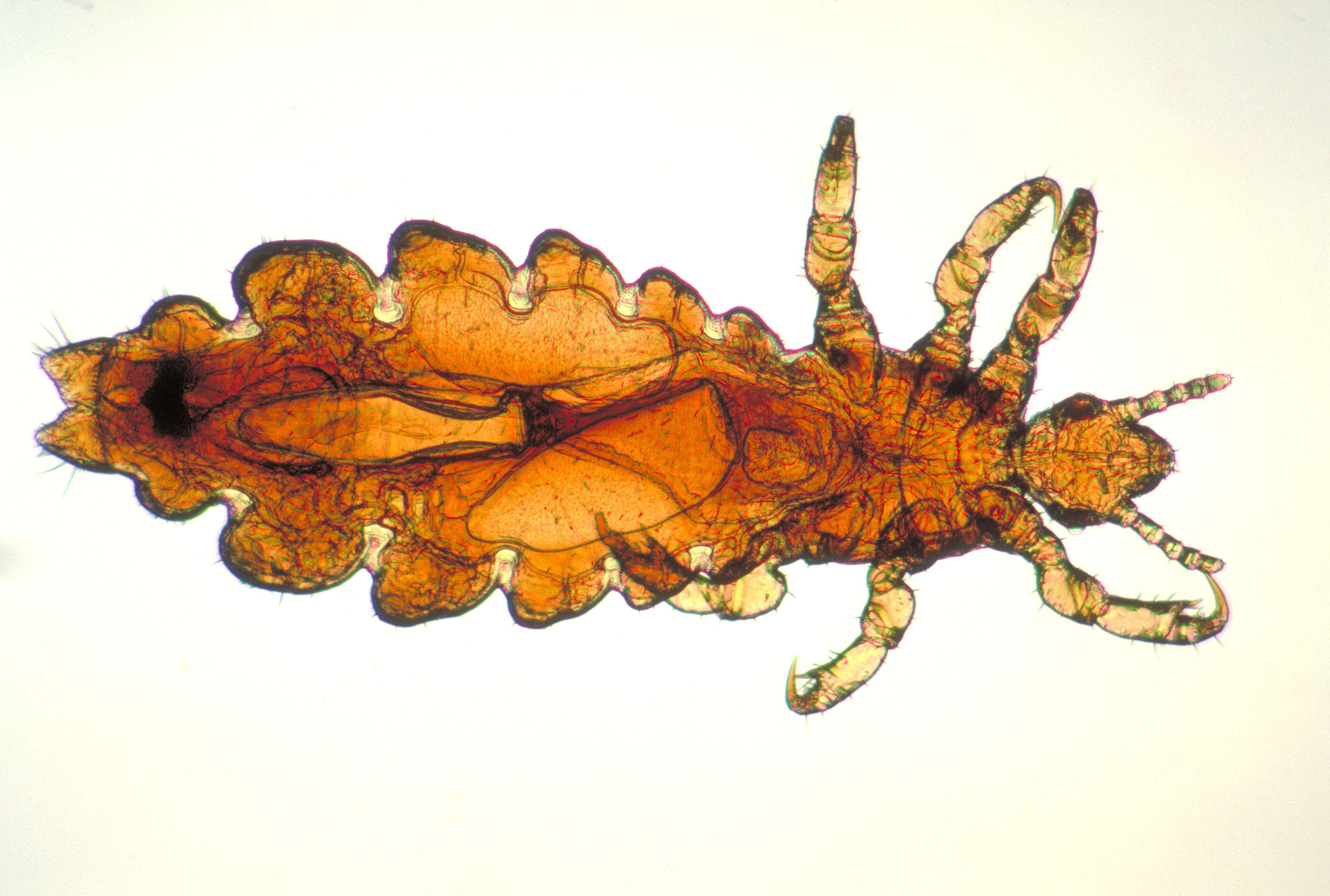 Image of head louse