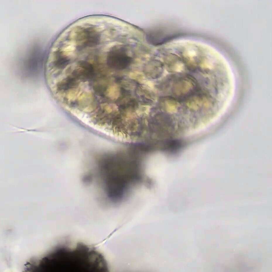 Image of reniform colpodean ciliate