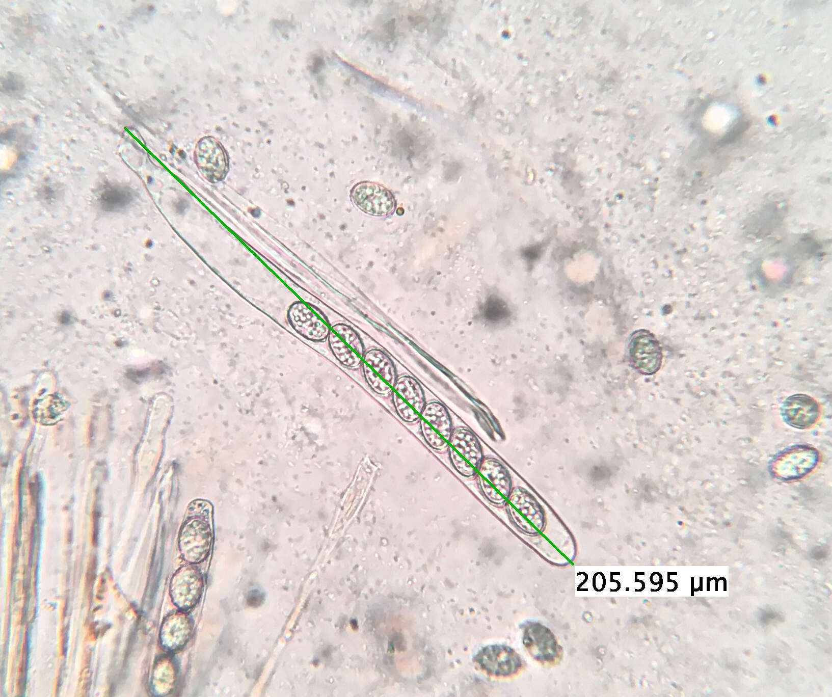 Image de Scutellinia vitreola Kullman 1982