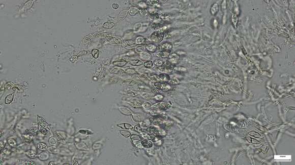 Image de Sirobasidium magnum Boedijn 1934