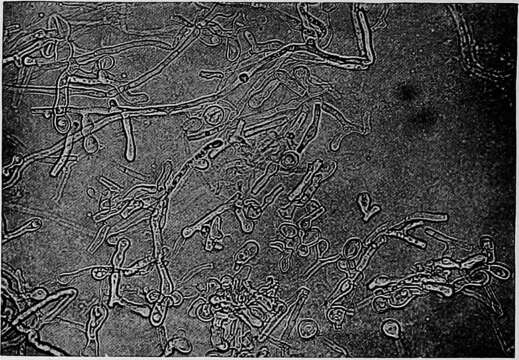 Image de Blastomyces dermatitidis Gilchrist & W. R. Stokes 1898