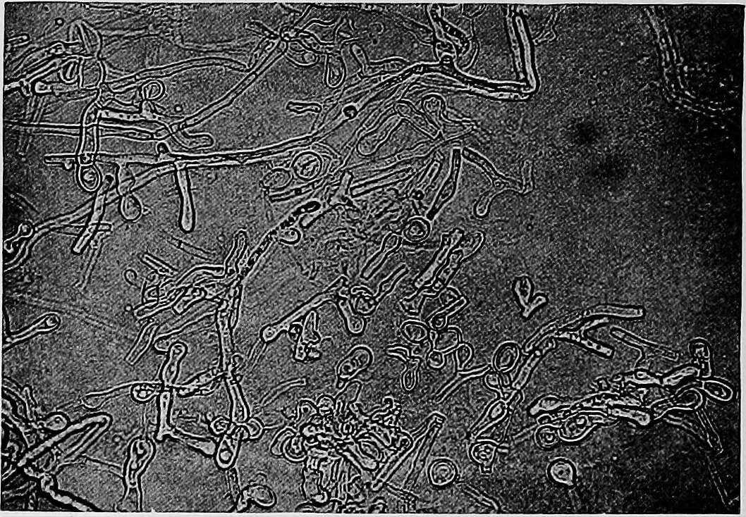 Image of Blastomyces dermatitidis Gilchrist & W. R. Stokes 1898