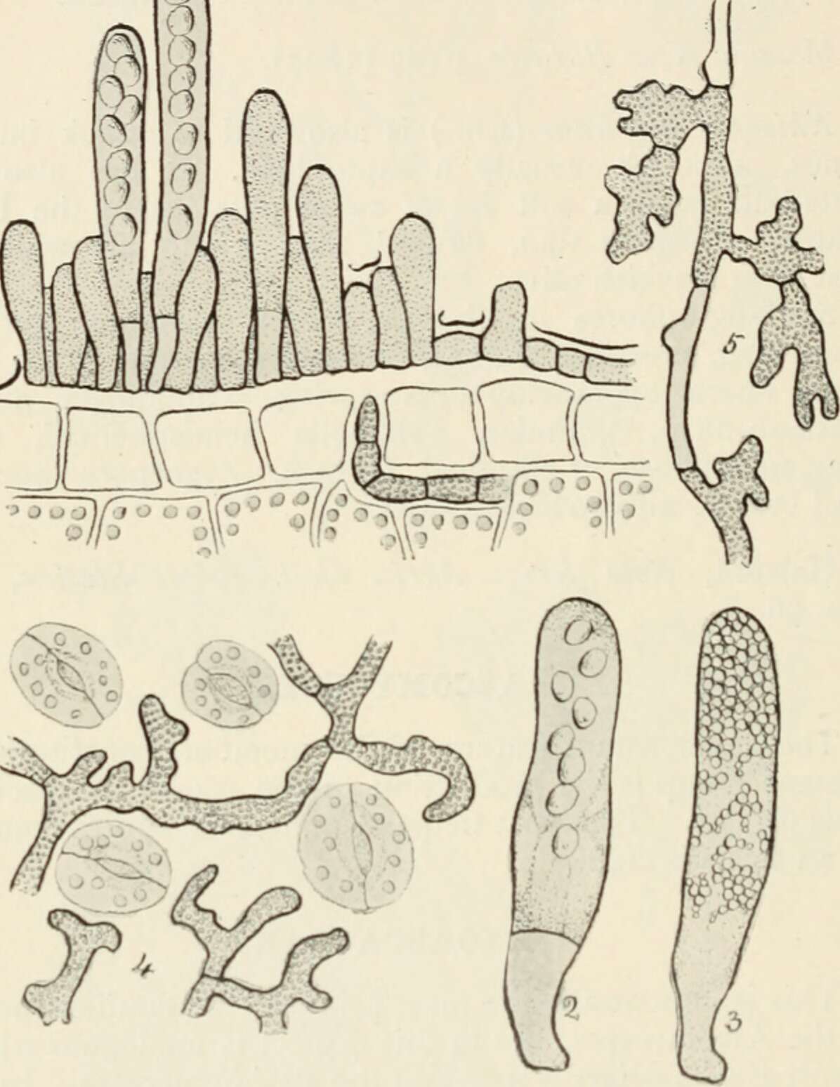 Image of Taphrina deformans (Berk.) Tul. 1866