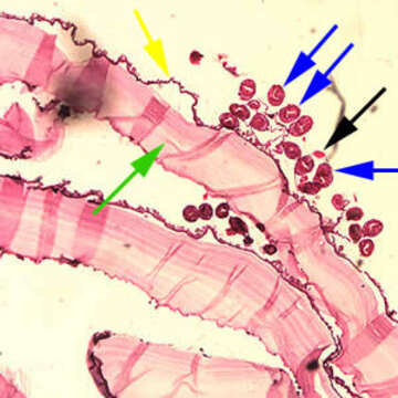 Image of Echinococcus granulosus