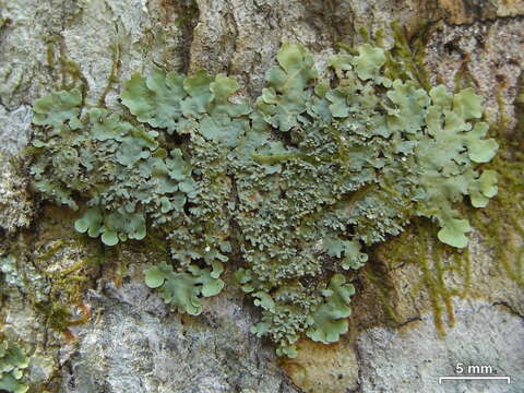 Image of lung lichen