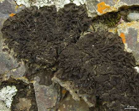 Image of skin lichen