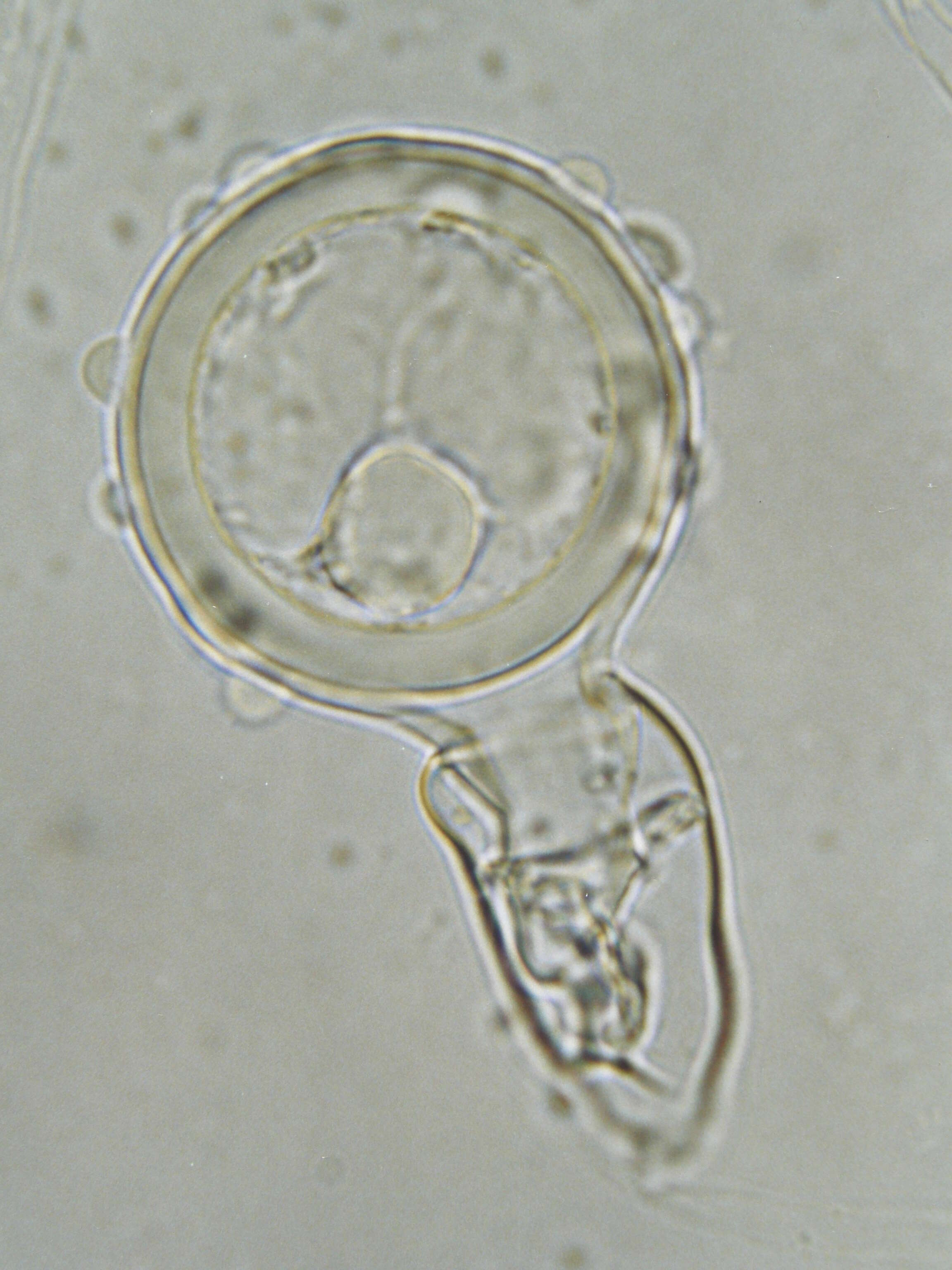 Image of Phytophthora cambivora