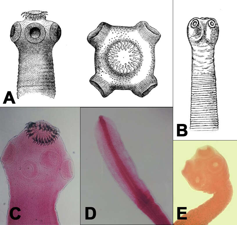 Image of cestodes